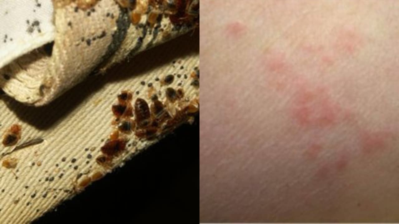 Plaga de chinches: esto es lo que debe hacer en caso de que las encuentre en su casa