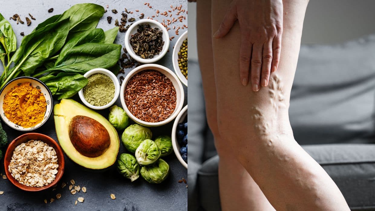 9 alimentos que ayudan a prevenir una trombosis (mejoran la circulación de la sangre)