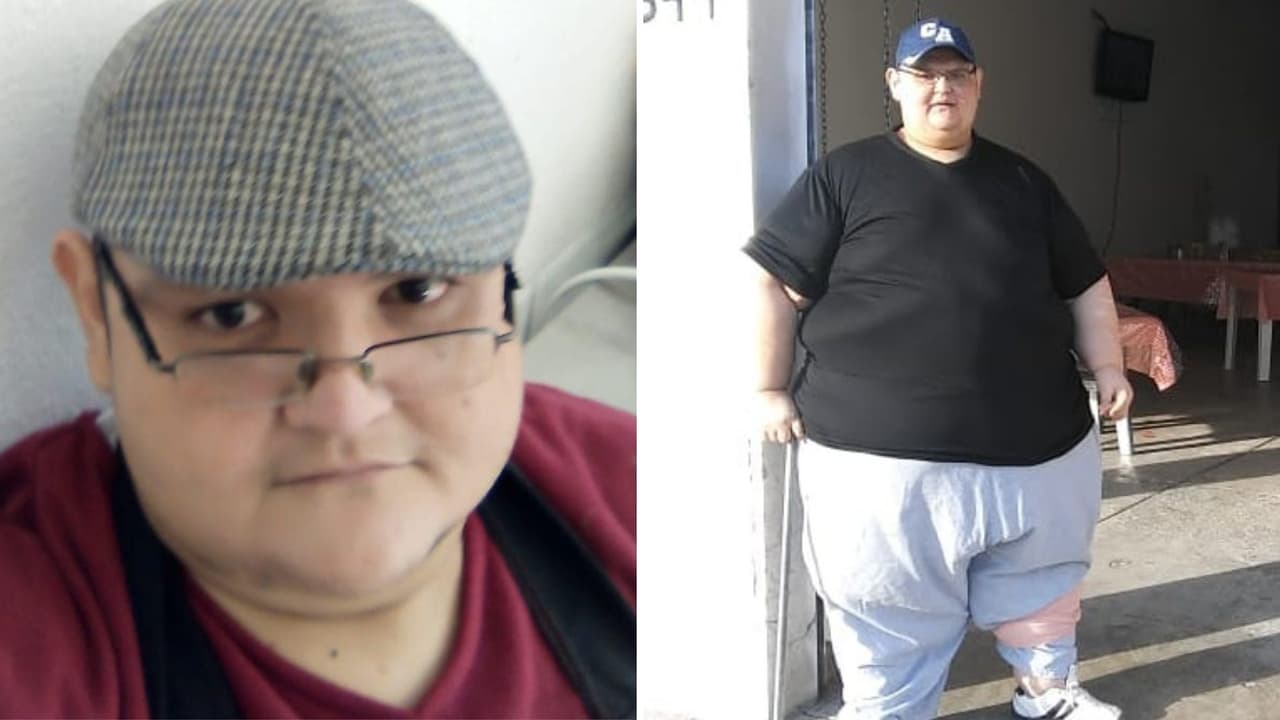 Muere Juan Pedro Franco, mexicano que fue el hombre más obeso del mundo: tenía 41 años