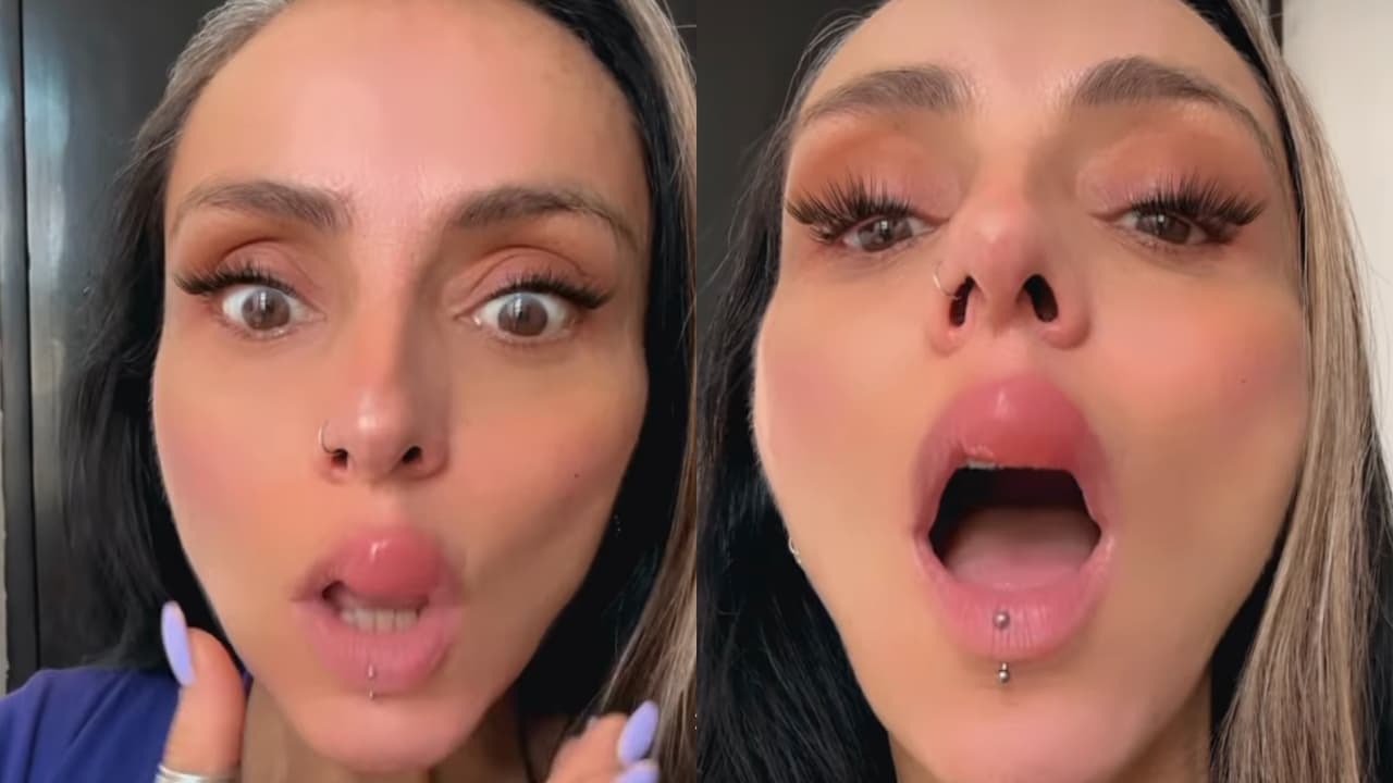 Ivonne Montero aparece con el labio desfigurado y clama ayuda: ¿secuela por "inyectarse" el rostro?