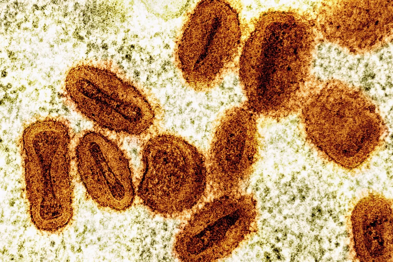 Dos científicos de un laboratorio del gobierno de EEUU son acusados de contrabandear viales de viruela del mono desde África