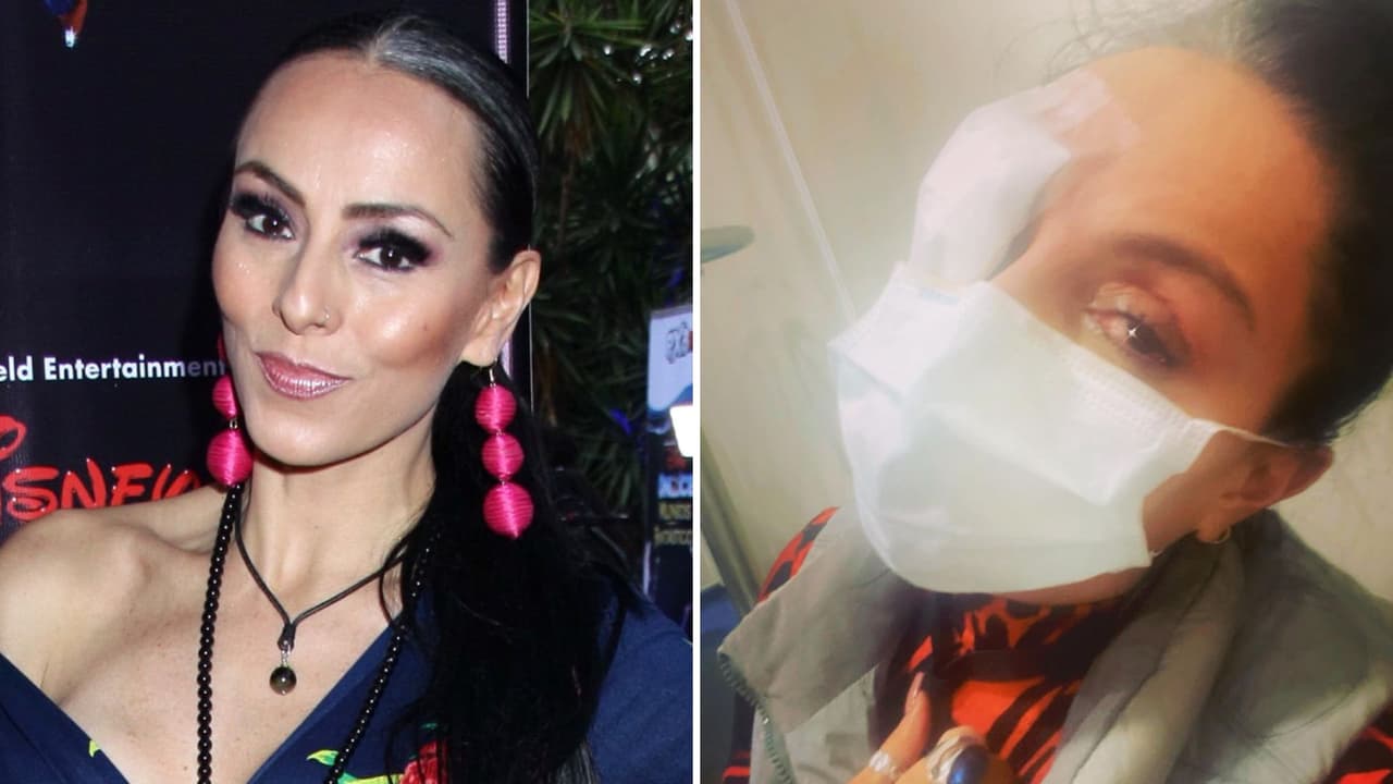 Ivonne Montero habla de las “extrañas” secuelas que le quedaron tras quemarse las córneas