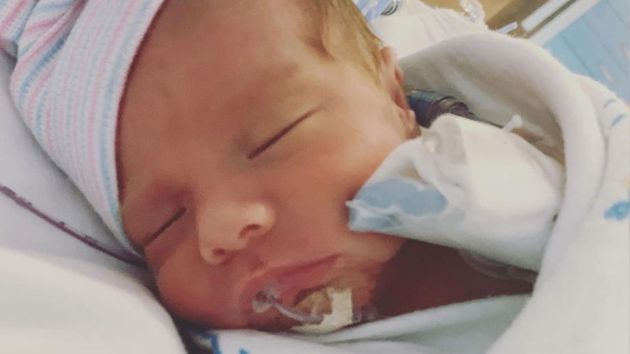 Se prefirió hacer una cesárea para salvar la vida del bebé, que
<b>inicialmente nacería el 9 de enero de 2022, pero lo hizo el 10 de noviembre de 2021.</b>