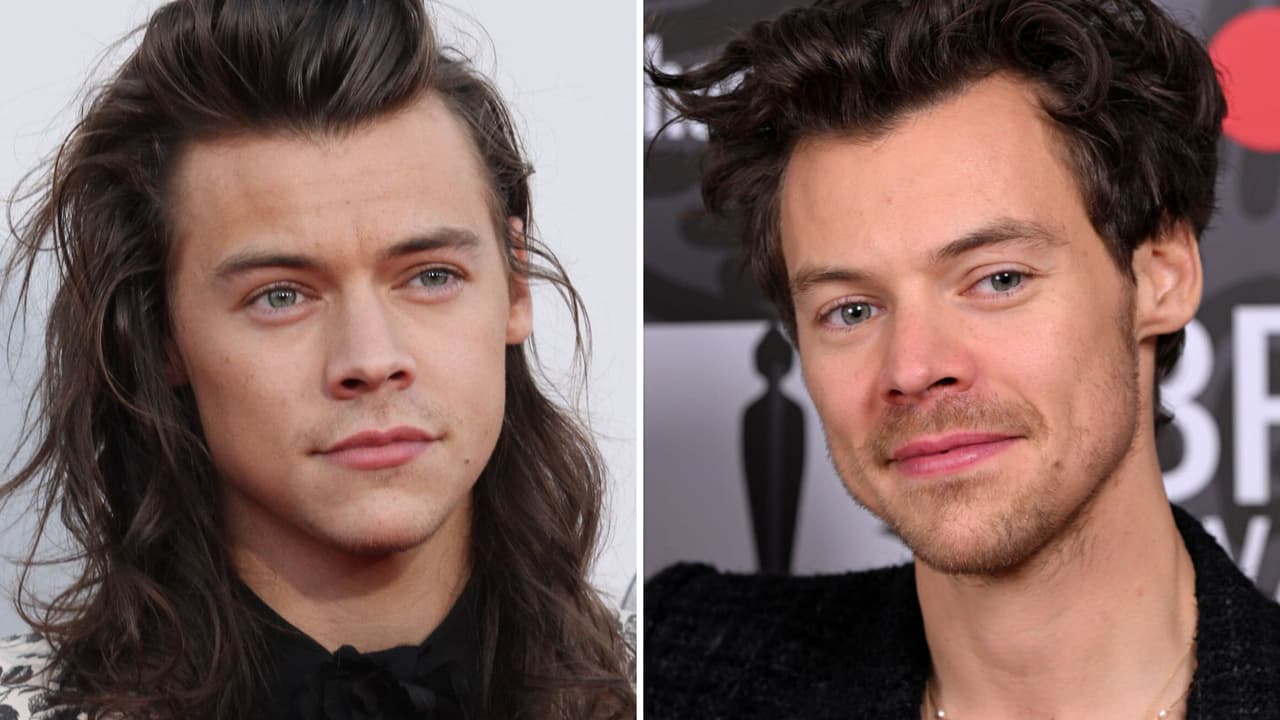 ¿Harry Styles está calvo a sus 30 años? Fans muestran supuestas pruebas y desatan debate