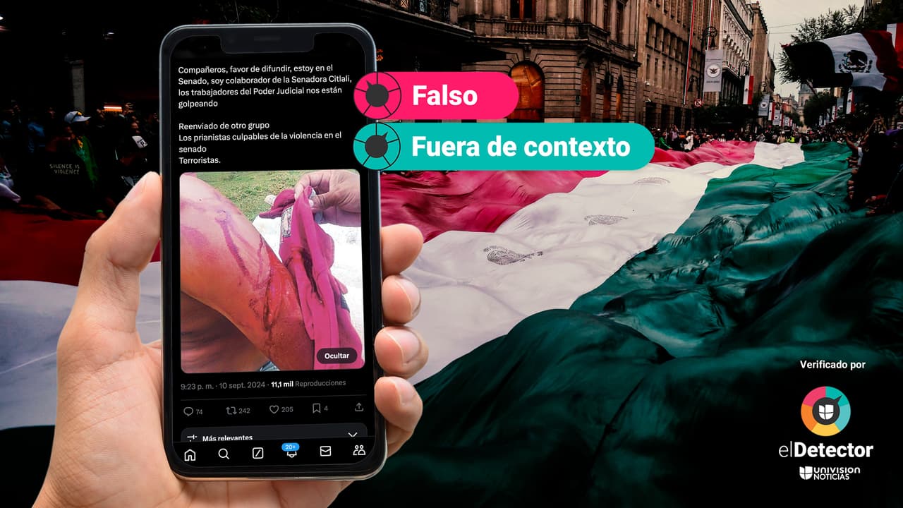 Esa imagen de un brazo ensangrentado no tiene relación con la manifestación por la reforma judicial en México: fue publicada antes de 2024