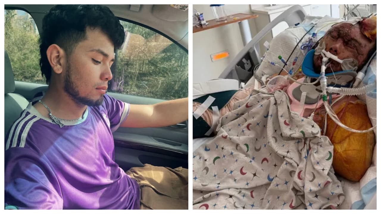 Joven salvadoreño pierde su brazo y lucha por su vida tras accidente en Maryland