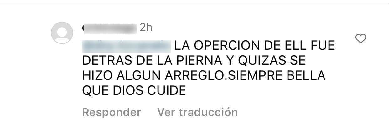 Una fan más sugirió que la modelo
<b>"quizás se hizo un arreglo"</b> estético que no estaba mostrando en la foto.
<br>