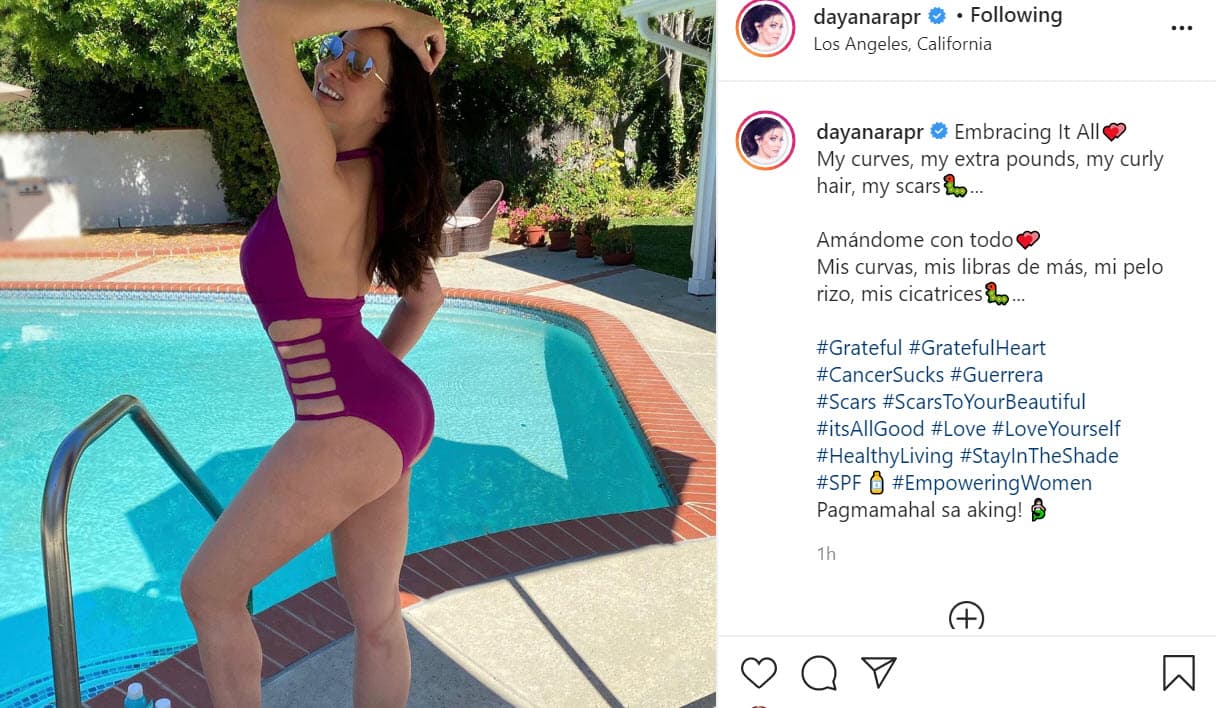 "
<b><a href="https://www.univision.com/famosos/dayanara-torres-rompio-a-llorar-al-recibir-refuerzos-inesperados-horas-antes-de-su-batalla-final-contra-el-cancer-video" target="_blank">Amándome con todo</a></b>. Mis curvas, mis libras de más, mi pelo rizo, mis cicatrices", escribió junto a
<b><a href="https://www.instagram.com/p/CC3oHrLJrvR/" target="_blank">esta foto</a></b> en la que se mostró sin filtros.