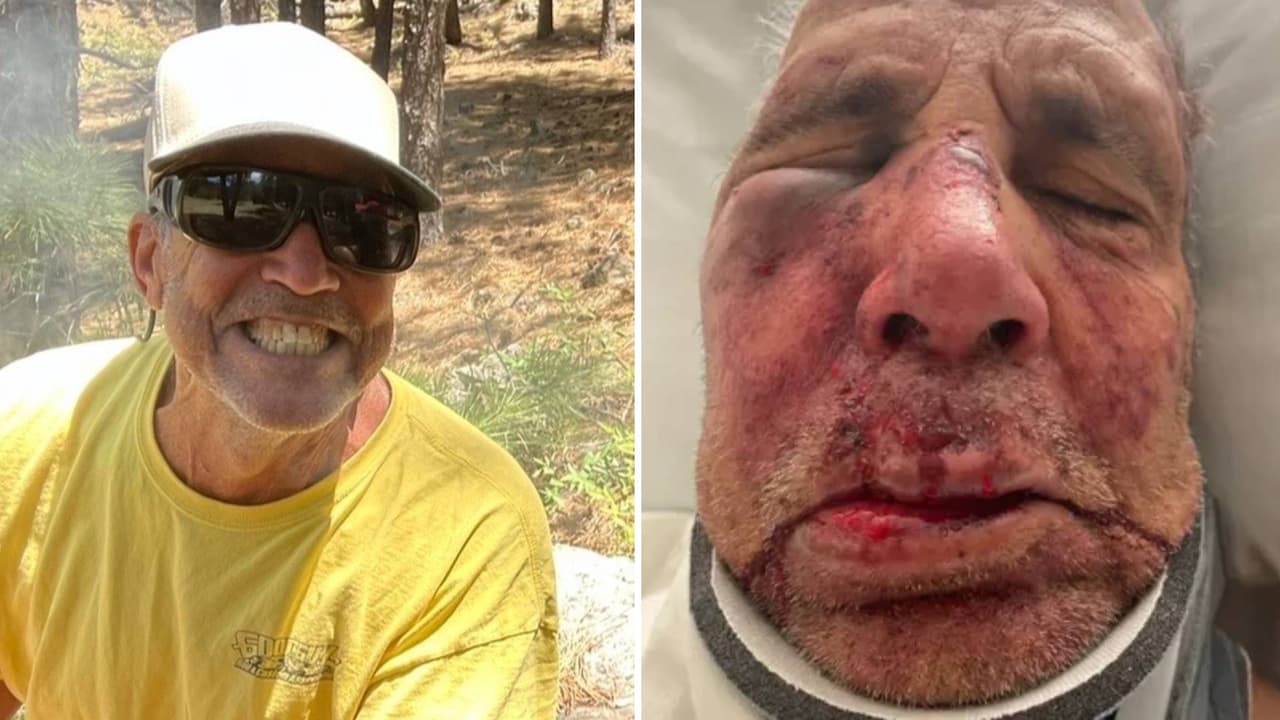 Sobreviviente de un tumor es brutalmente atacado mientras paseaba a su perro en Phoenix: Desconocidos lo salvaron