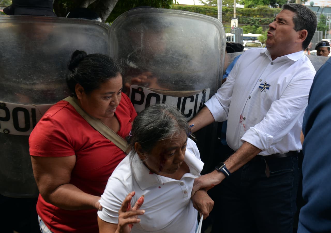 El departamento del Tesoro sanciona a la policía de Nicaragua por violaciones de derechos humanos