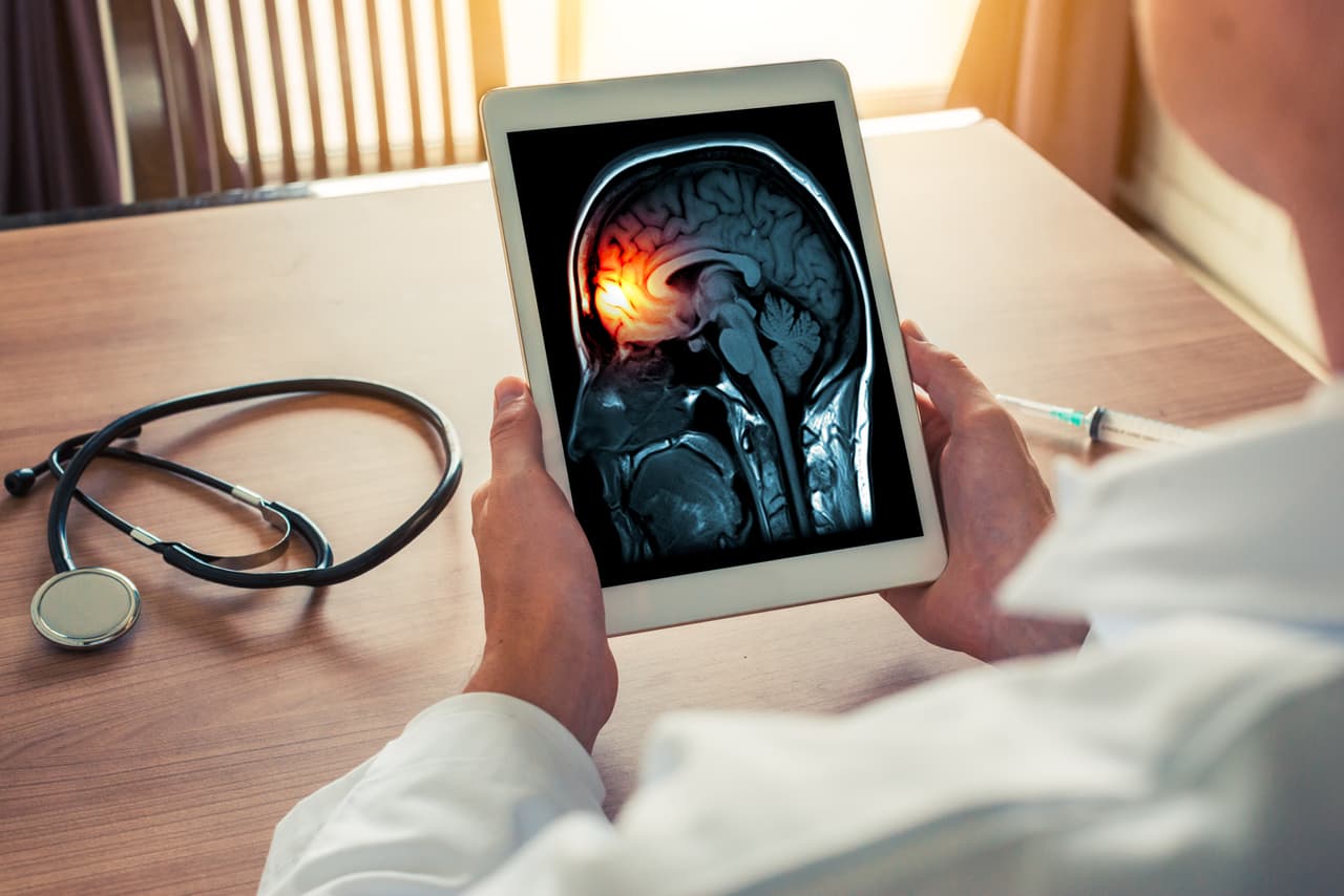 <b>Puesto 20. Meningitis: 0.51%.</b> 288,021 muertes en 2017.
<br>
