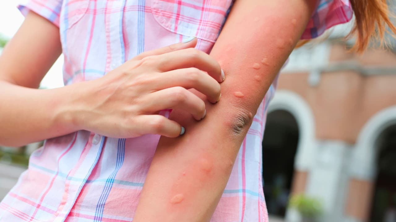 <h3 class="cms-H3-H3">Cómo proteger a tu familia al salir</h3>
<br>Usa ropa clara, ligera y de manga larga.
<br>Evita paseos al aire libre al amanecer y atardecer.
<br>En bebés menores de 2 meses, no uses repelente:
<b>protégelos con mosquiteros y ropa.</b>