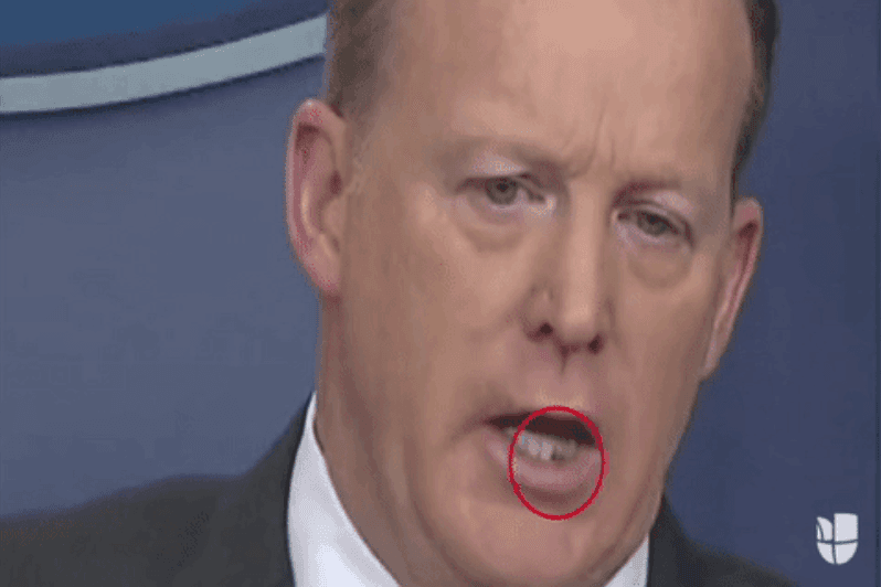 <b>6. Tuvo lechuga entre los dientes</b>
<br>Mientras el 27 de marzo,
<b><a href="http://www.univision.com/temas/sean-spicer">Sean Spicer</a></b> hablaba en conferencia de prensa desde la Casa Blanca, algo del propio vocero capturó la atención y las miradas de quienes seguían su intervención: una mancha oscura en sus dientes. ¿Lechuga? Algunos especulaban sobre el problema de dar ruedas de prensa luego del almuerzo mientras que otros se preguntaron si alguien de la Casa Blanca tenía un palillo a mano para Spicer.