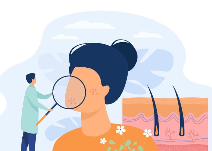 Chequeo dermatológico: tu mejor defensa contra el cáncer de piel. Qué revisar y cuando ir