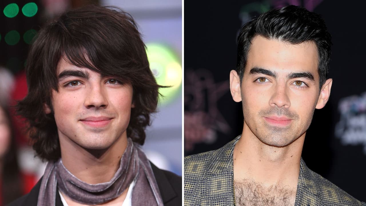 Joe Jonas reveló los retoques estéticos que se ha hecho a sus 33 años