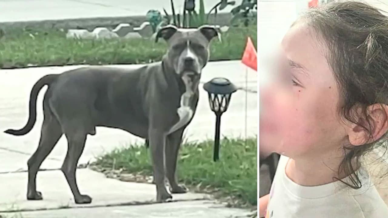 “Ellos sabían que ese perro era agresivo”: perro que atacó a abuela también mordió a niña, denuncian vecinos