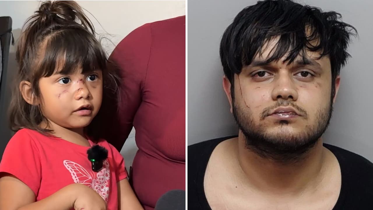 Niña de 3 años atacada en parque de San Antonio podría sufrir estrés agudo, advierte psicóloga