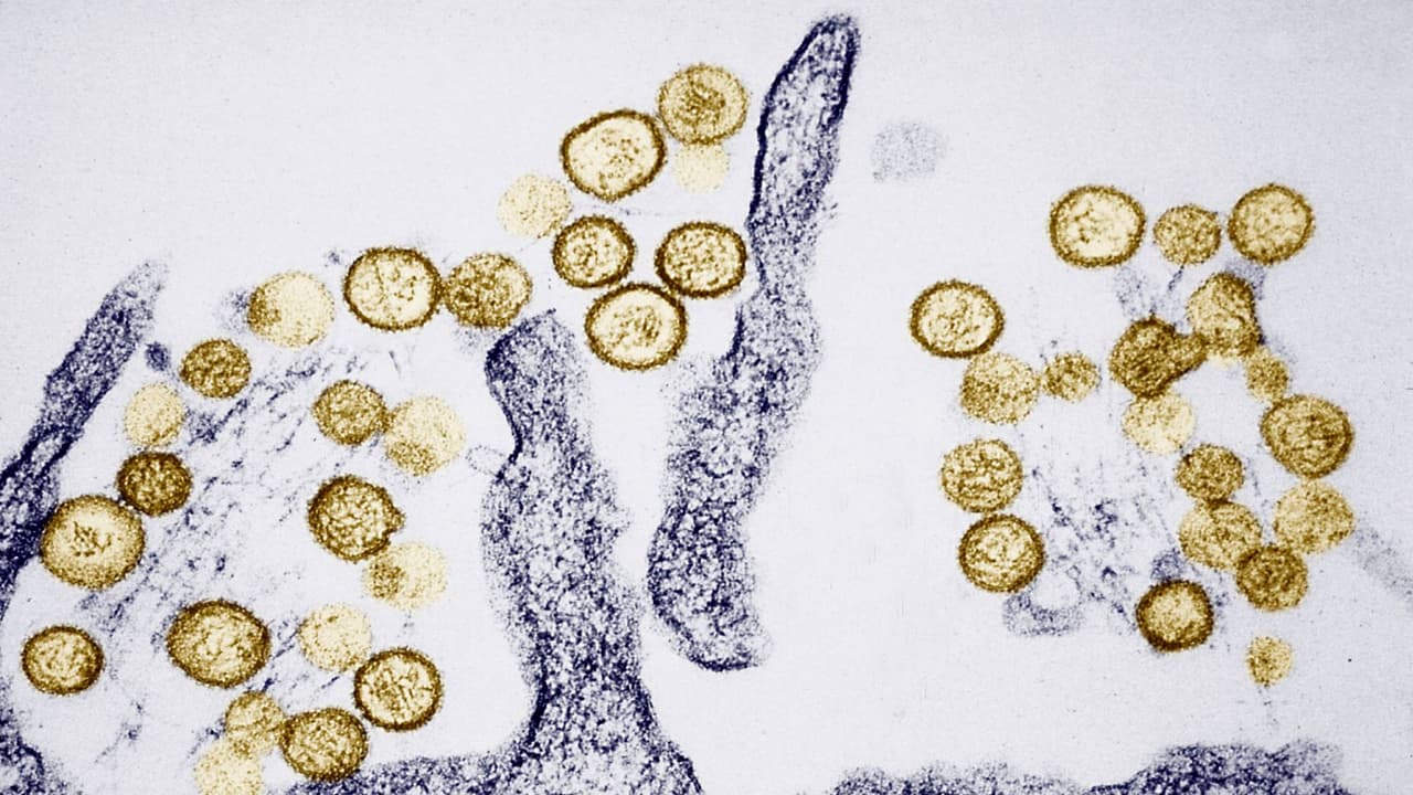 Confirman primera muerte por hantavirus en Arizona: ¿Qué dicen las autoridades?