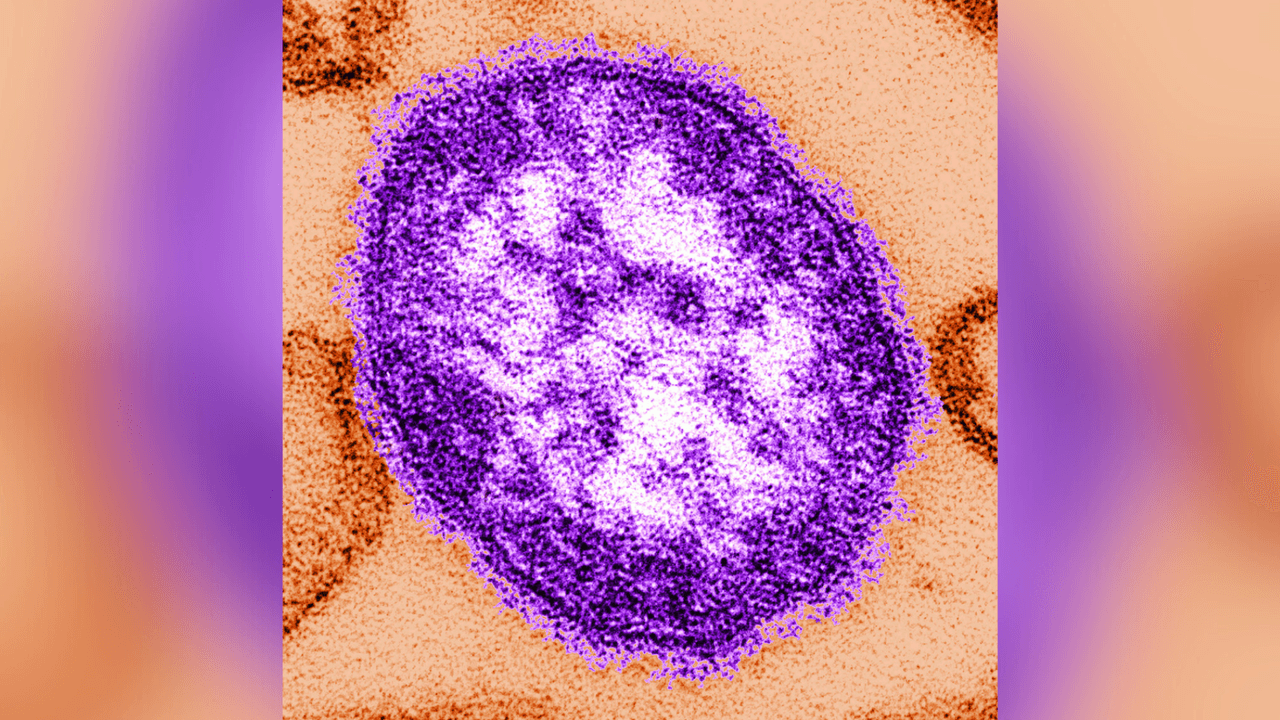 Los casos de sarampión en Estados Unidos aumentarán en 2024: ¿qué los está impulsando?