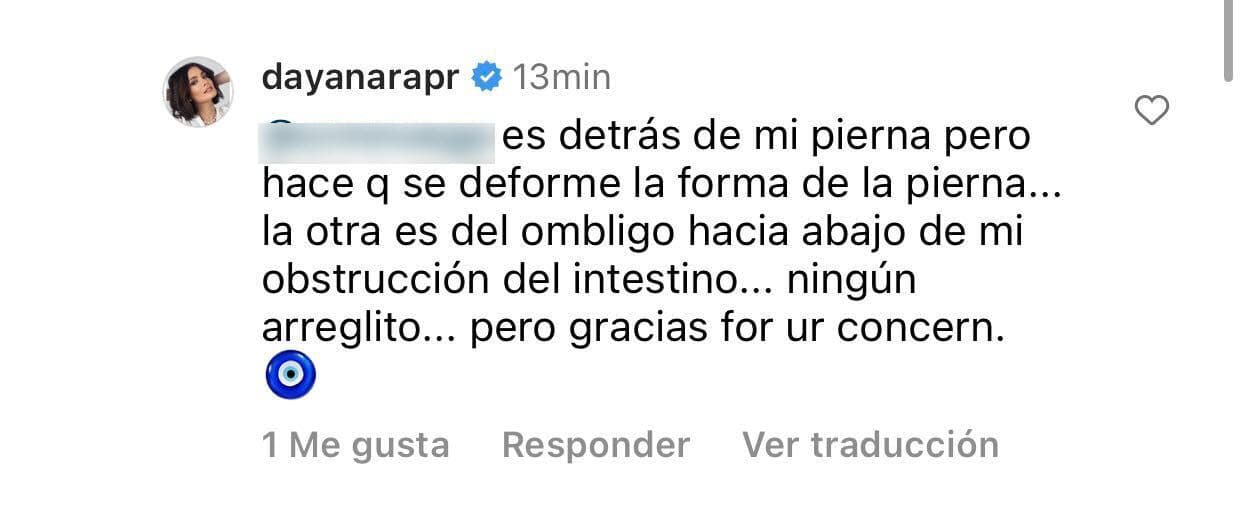 Dayanara Torres le explicó que la otra operación a la que se sometió mientras tuvo cáncer le dejó una cicatriz por donde está el ombligo "abajo de mi obstrucción de mi intestino":
<b>"Ningún arreglito"</b>, advirtió.
<br>