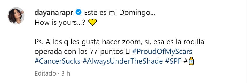"Este es mi domingo, ¿cómo va el tuyo?", escribió con la publicación de la imagen.
<br>
