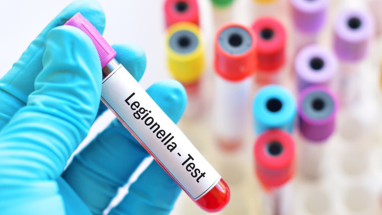 Nueva York identifica 50 edificios con Legionella en Manhattan; brote suma 84 casos