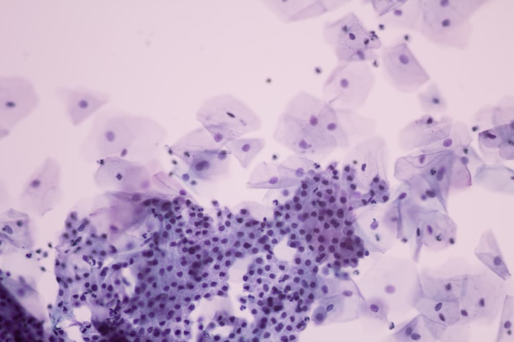 ¿Las mujeres adultas deben vacunarse contra el VPH? Esto es lo que debes saber