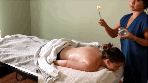 9 beneficios de las ventosas chinas por las que deberías darle una oportunidad como los atletas olímpicos