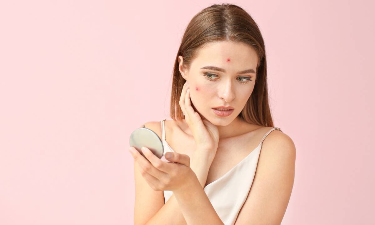 6 tips para lucir un maquillaje perfecto si tienes acné