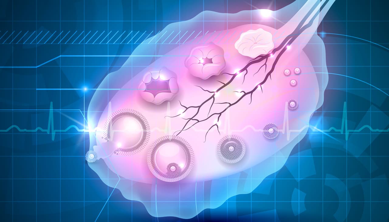 El quiste de ovario puede ser algo grave si presentas los siguientes síntomas