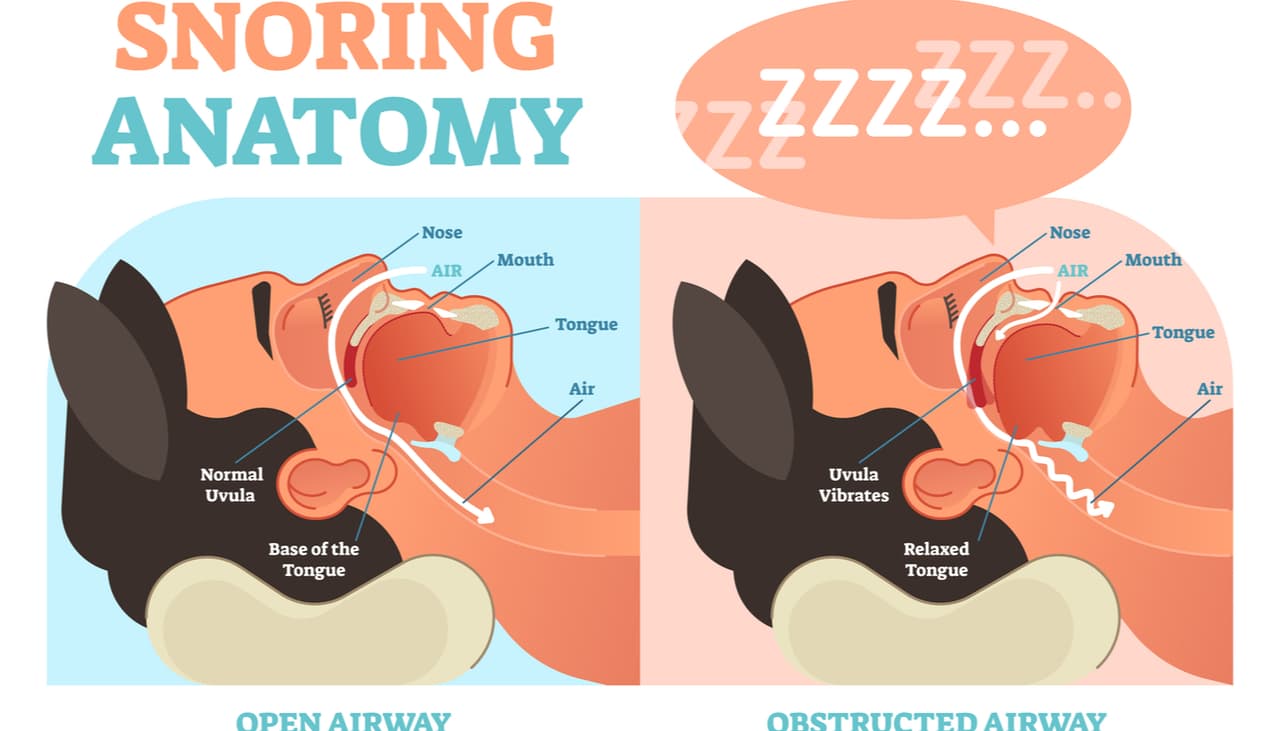 ¿Los ronquidos de tu pareja no te dejan dormir? 9 remedios para ponerle fin al problema